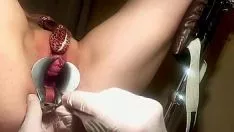 Играть Шейка матки выскочила, дуэнциклопатия, аномалия, гинекологический осмотр
