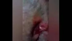 Oynat Tuzlu çözelti atış deliği